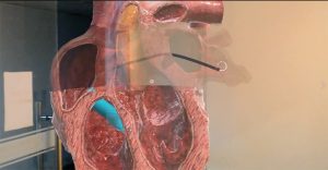 波士顿科学HoloLens心脏医疗项目演示
